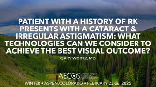 Case: Patient with a history of RK presents with a cataract & irregular astigmatism: What technologies can we consider to achieve the best visual outcome?